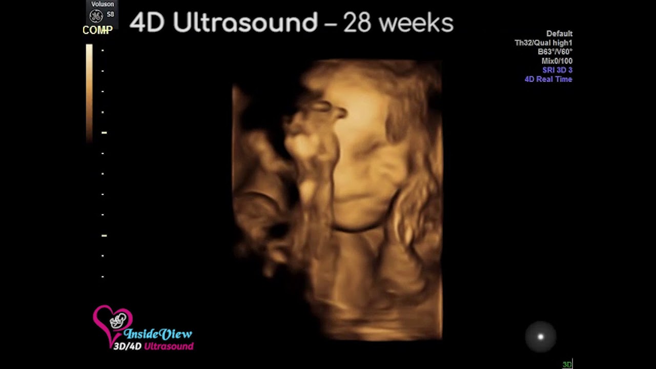 3D & 4D Ultrasounds near Olympia WA - Inside View 3D/4D Ultrasound