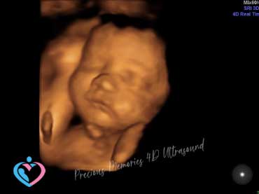 3D Ultrasounds - 4D Ultrasounds in Houston Texas and Humble Texas