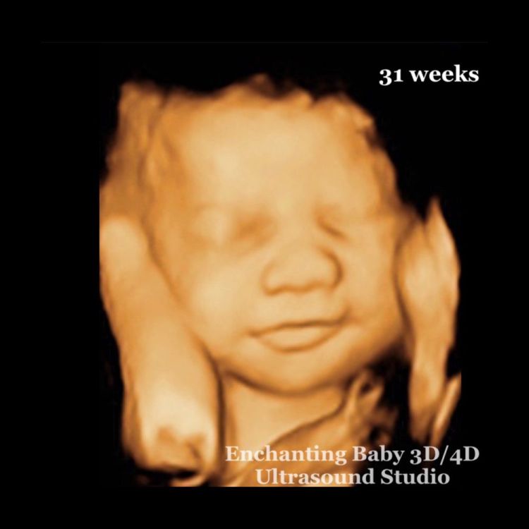 ENCHANTING BABY 3D/4D ULTRASOUND STUDIO - 71 Photos & 82 Reviews - Ultrasound Imaging Centers - 1921 S Alma School Rd, Mesa, AZ - Phone Number - Yelp