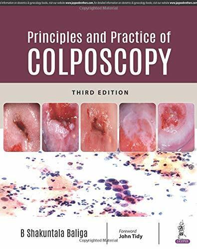 Principles and Practice of Colposcopy by B. Shakuntala Baliga (2018, Hardcover, Revised edition) for sale online - eBay