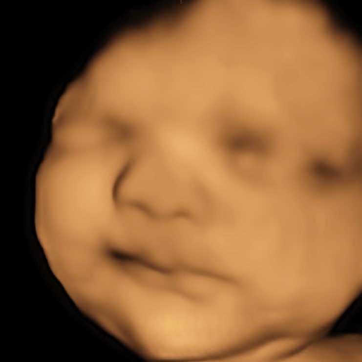 https://overthewombstudios.com/uncategorized/what-is-the-difference-between-3d-and-4d-ultrasound/
