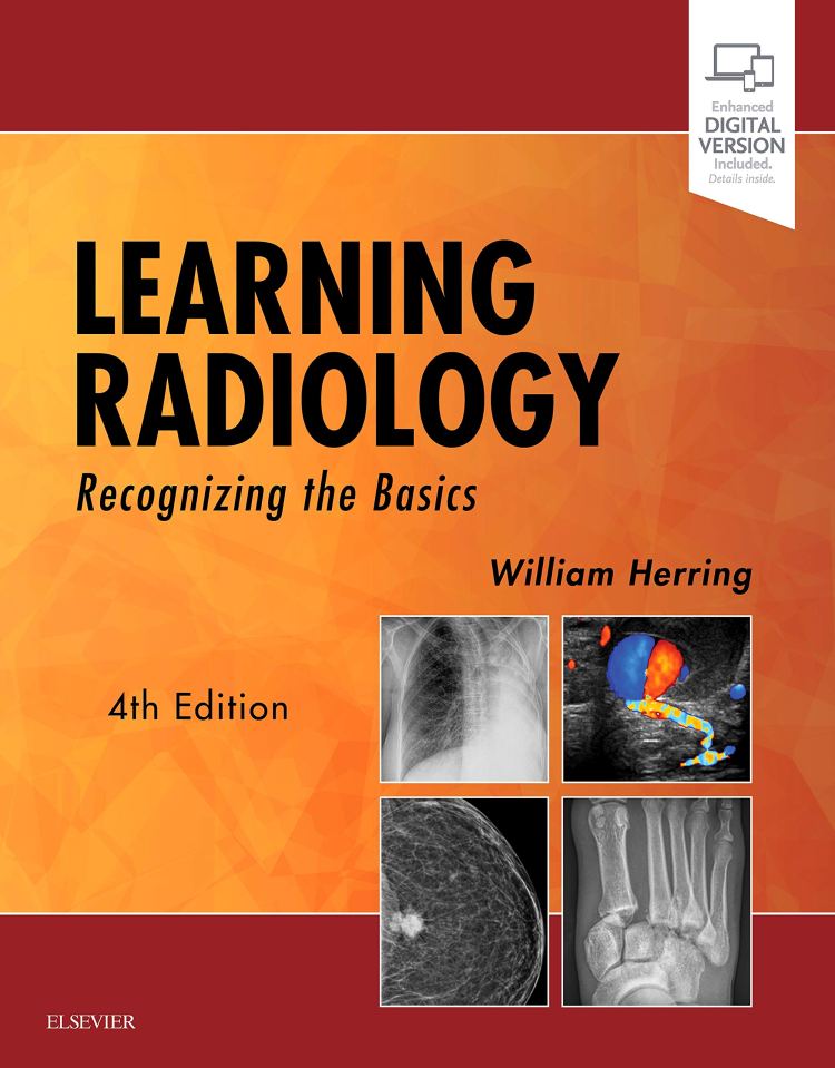 Learning Radiology: Recognizing the Basics: 9780323567299: Medicine & Health Science Books @ Amazon.com