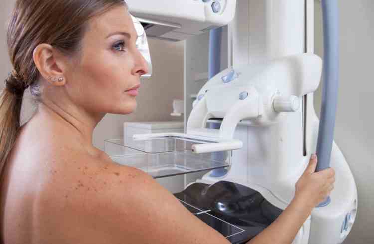 mammography