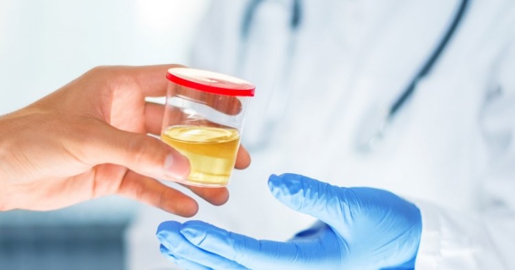 urine general test