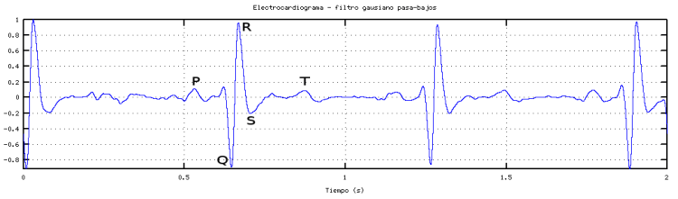electrocardiograma