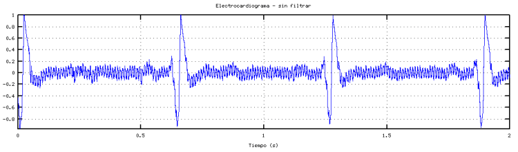 electrocardiograma